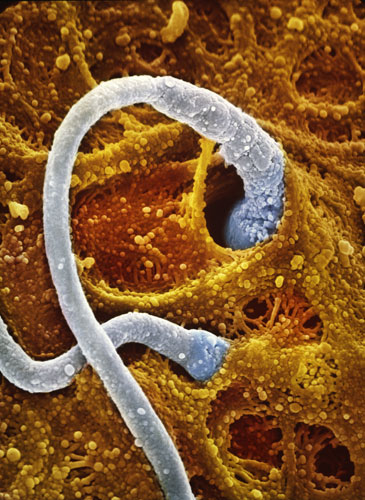 0210 受孕 两个精子钻入一个卵子的壳内.jpg