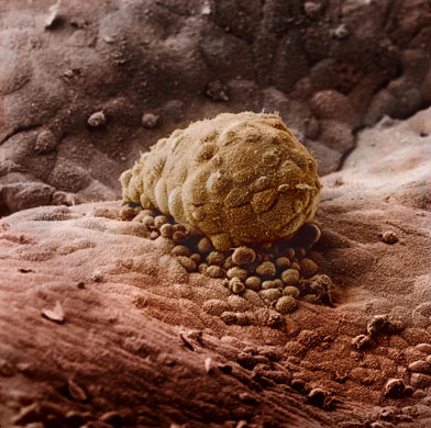 0410 8天后 新孕育的胚胎定位在某最佳位置，并吸附在黏膜上.jpg