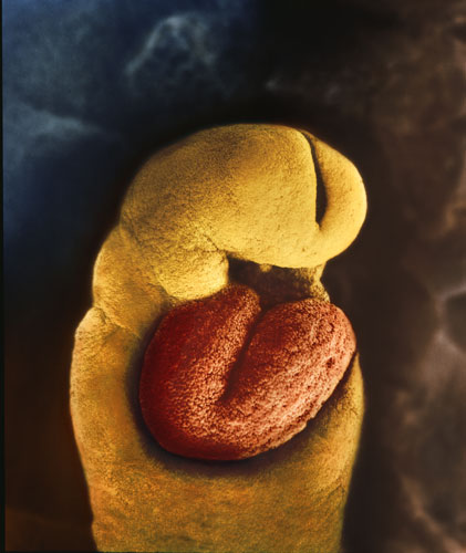 0610 24天后 第一批发育的器官之一心脏开始跳动.jpg