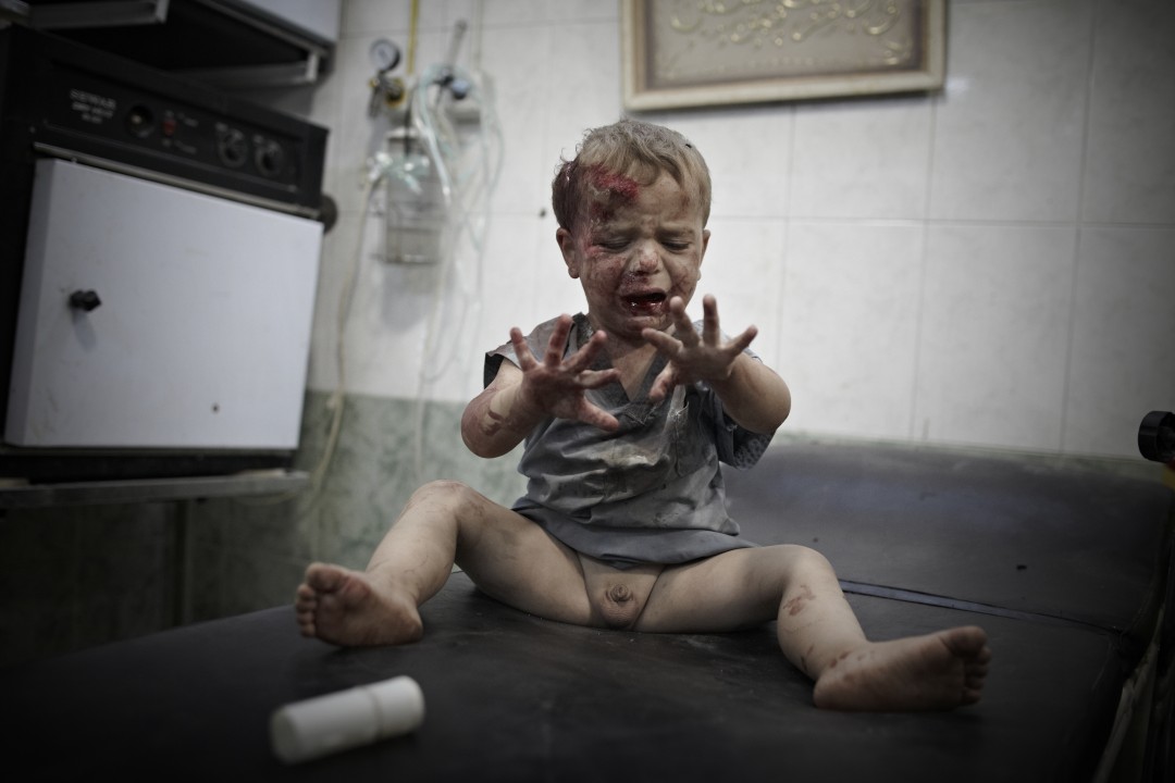 Wounded Baby, Aleppo (2).jpg
